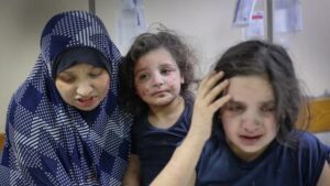 Anak-anak Palestina yang terluka akibat serangan bom Israel.