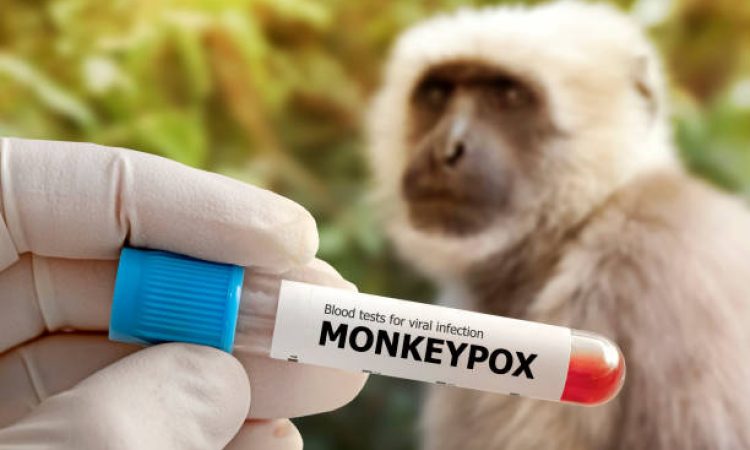 medical worker holds a test tube with Monkeypox virus infected blood sample in his hands,hands in gloves close-up against the background of a sad monkey. Animal epidemic. Epidemic of smallpox monkeys in Europe and the USA.