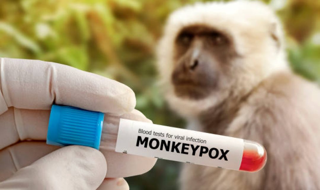 medical worker holds a test tube with Monkeypox virus infected blood sample in his hands,hands in gloves close-up against the background of a sad monkey. Animal epidemic. Epidemic of smallpox monkeys in Europe and the USA.